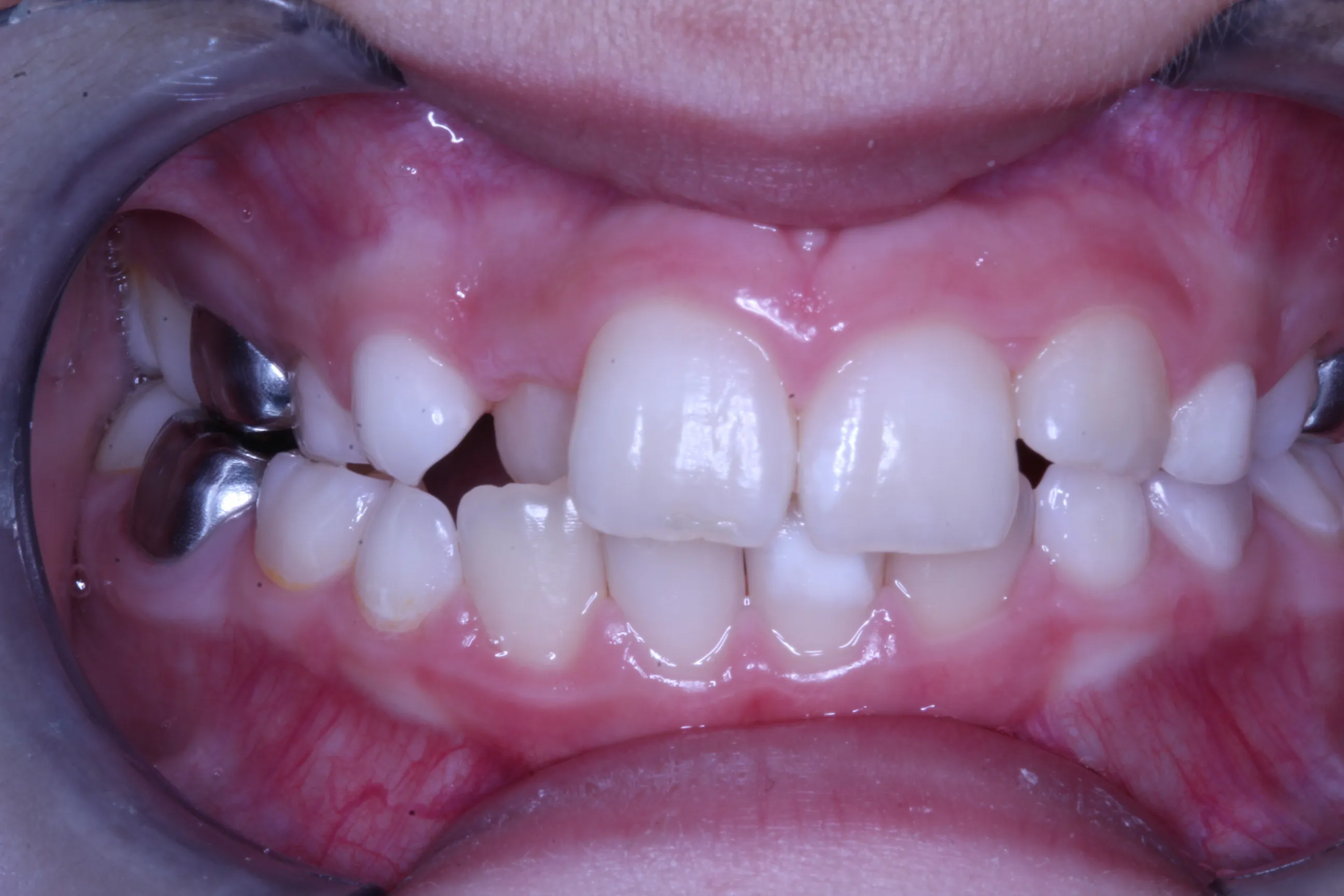 smile-gallery gallery